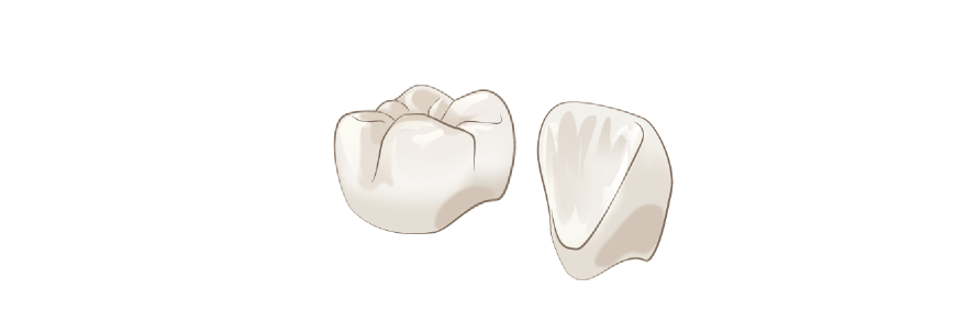 つやのある美しい白さ・周囲の歯と馴染む仕上がり
