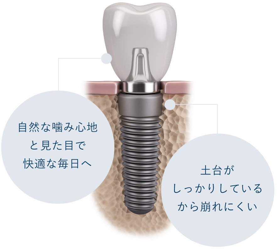 「自然な噛み心地と見た目で快適な毎日へ」「土台がしっかりしているから崩れにくい」