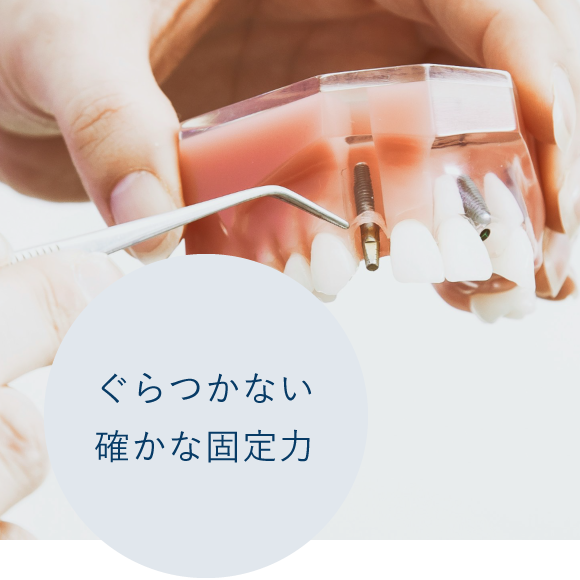 ぐらつかない確かな固定力