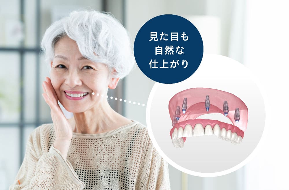 見た目も自然な仕上がり