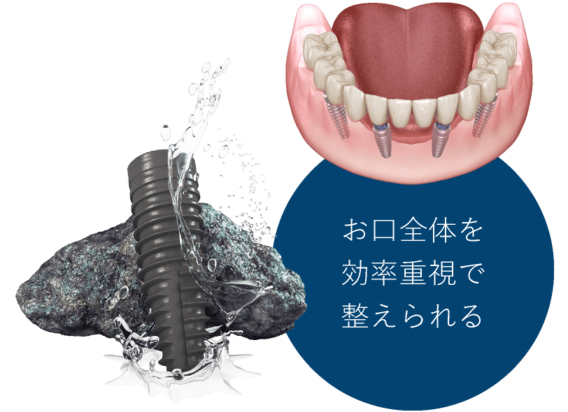 お口全体を効率重視で整えられる