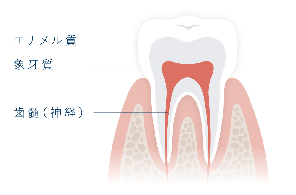 セラミックシェル