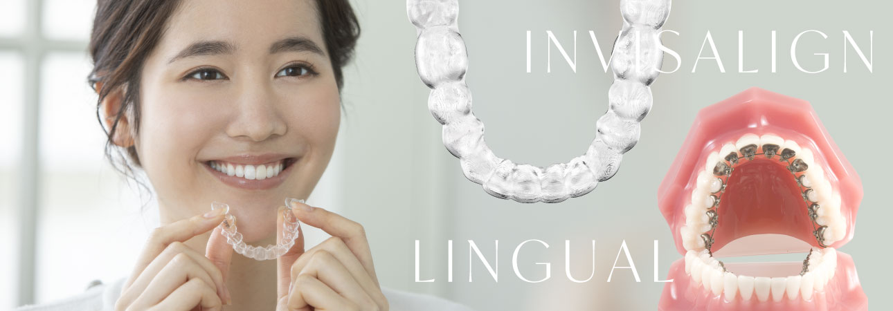 INVISALIGN / LINGUAL