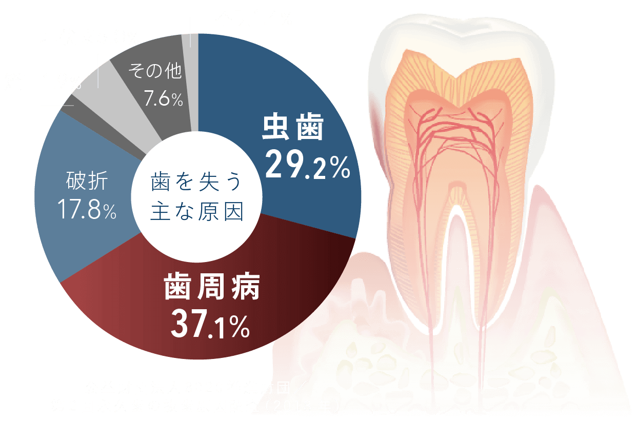 公益財団法人8020推進財団／第2回永久歯の抜歯原因調査（2018年）