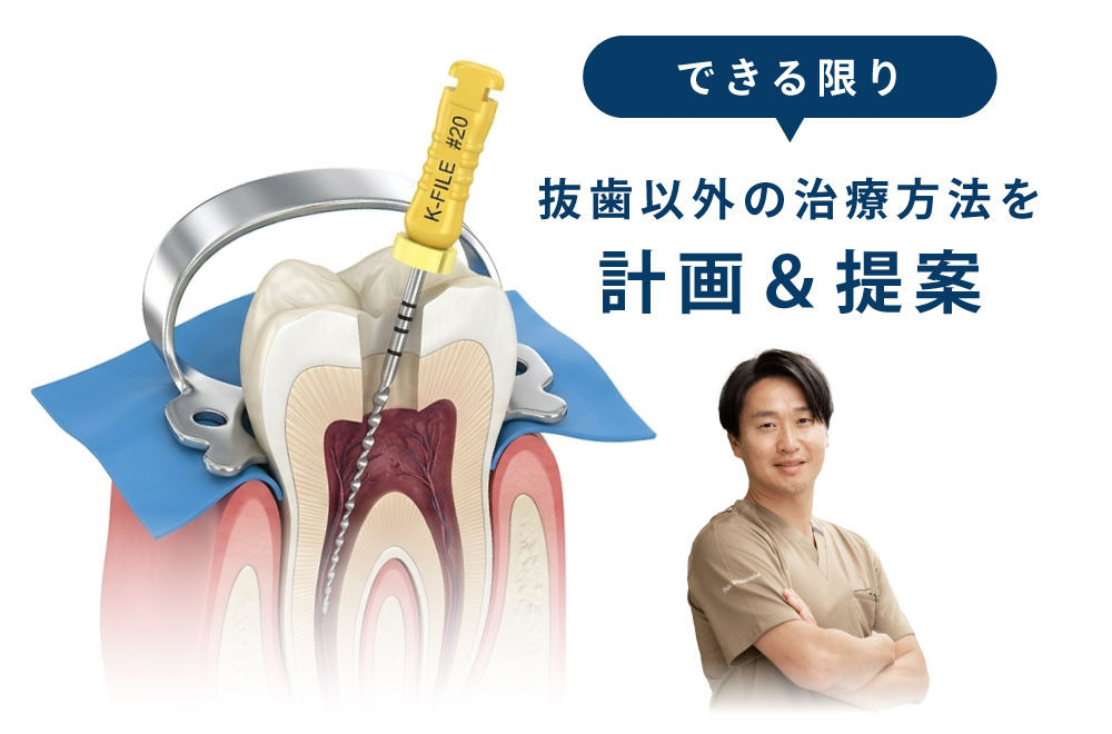 できる限り抜歯以外の治療方法を計画&提案