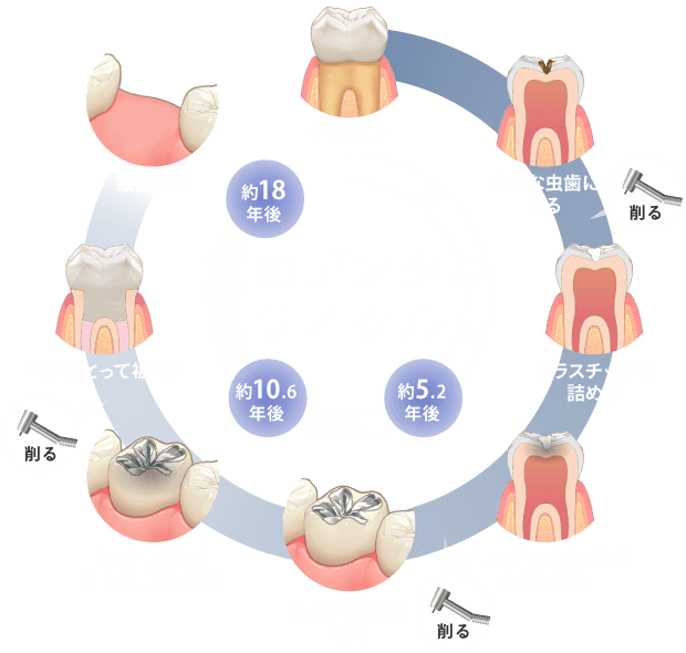 負のデンタルサイクル