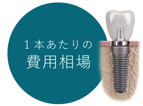 1本あたりの費用相場